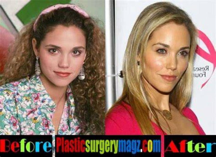 Elizabeth Berkley Nose Job Plastic Surgery Before and After
