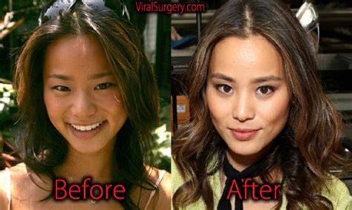 Jamie Chung Plastic Surgery Before and After