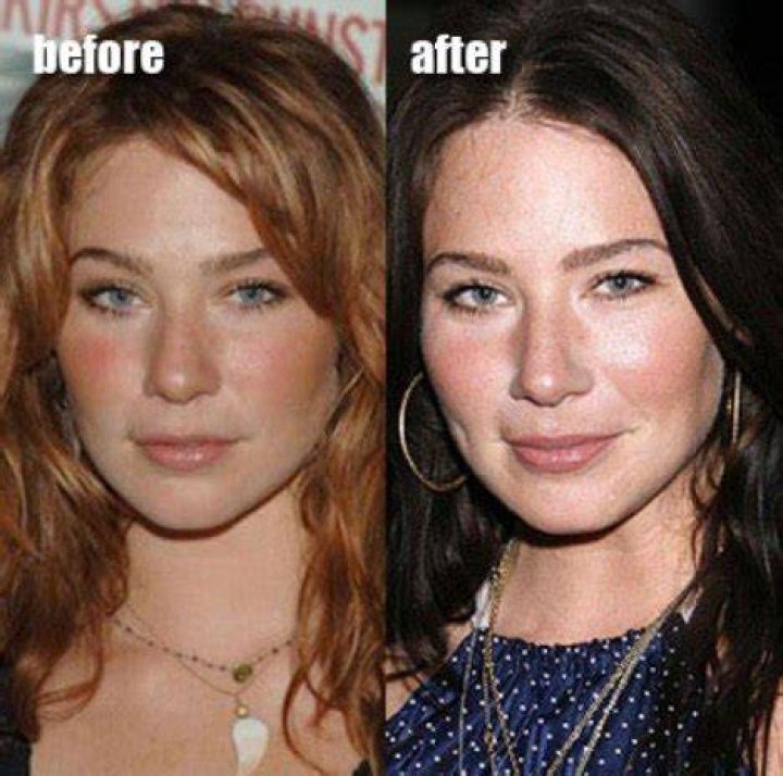 Lynn Collins Plastic Surgery Before and After