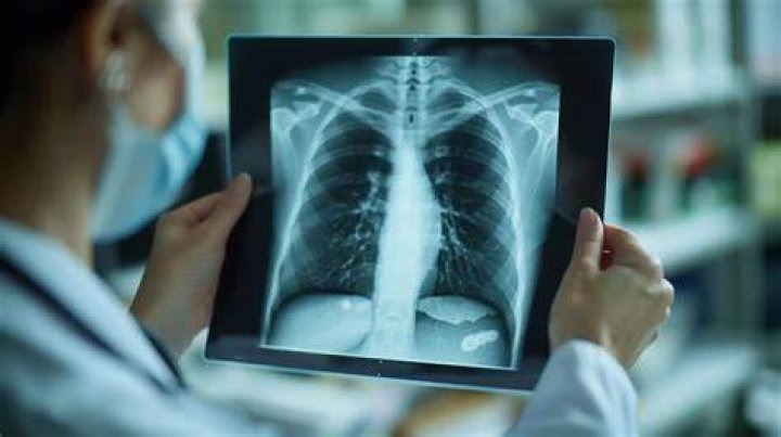 Mesothelioma Find Out About Explores New Remedy When Chemotherapy Fails