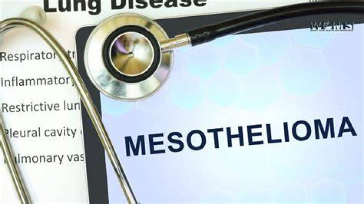 Mesothelioma Study Explores New Treatment When Chemotherapy Fails