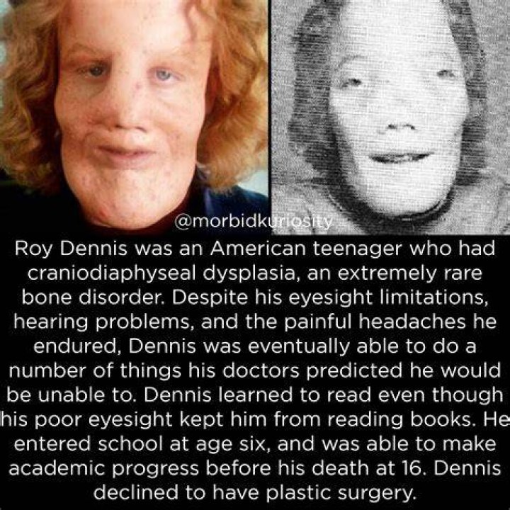 Rocky Dennis