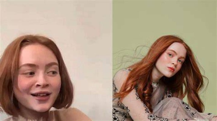 Sadie Sink Plastic Surgery